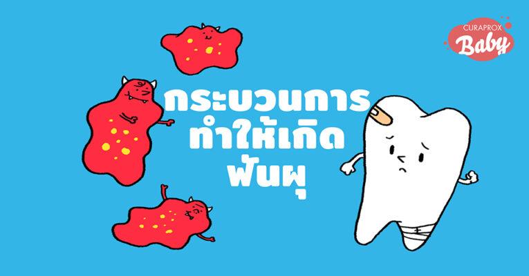 กระบวนการทำให้เกิดฟันผุ