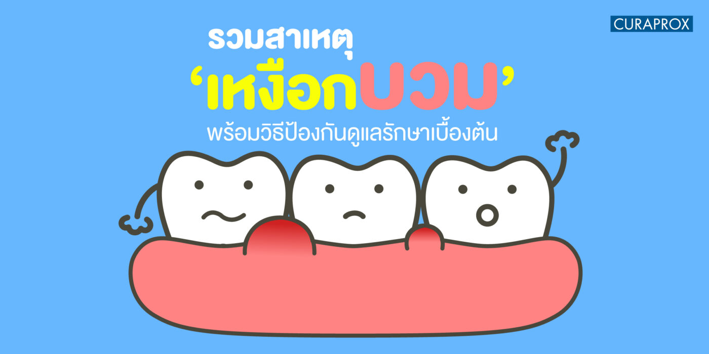 เหงือกบวม
