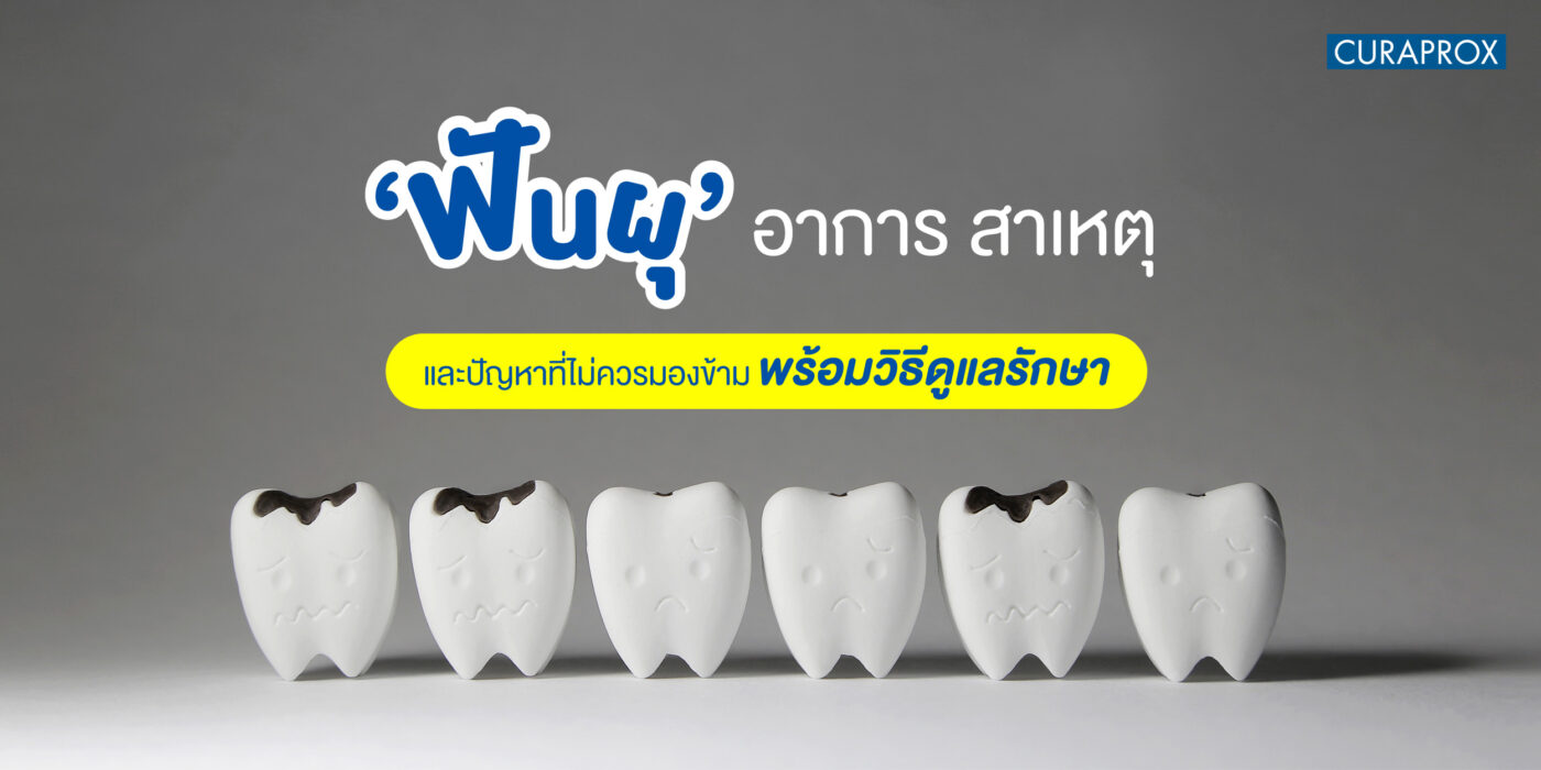 ฟันผุ