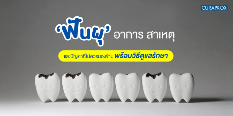 ฟันผุ
