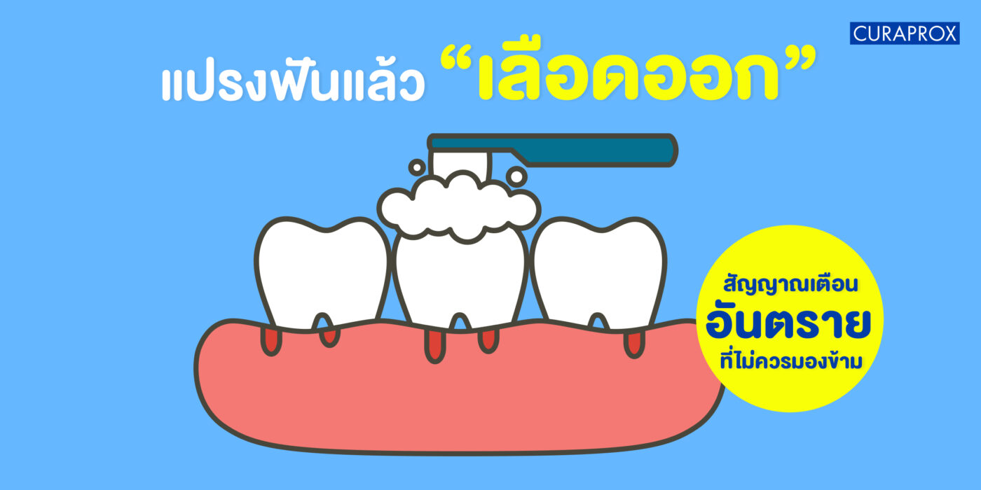 แปรงฟันแล้วเลือดออก