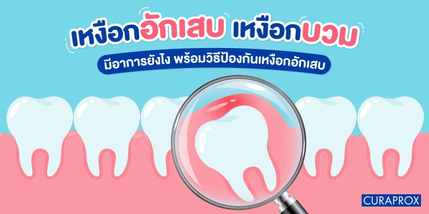 เหงือกอักเสบ
