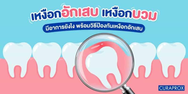 เหงือกอักเสบ