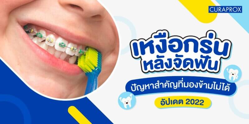 เหงือกร่น จัดฟัน