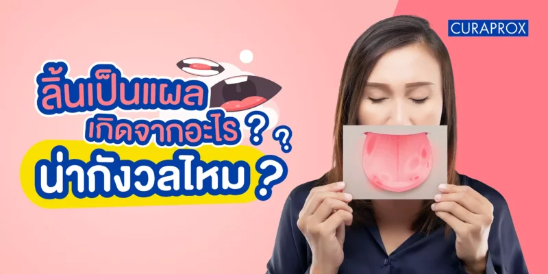 ลิ้นเป็นแผล