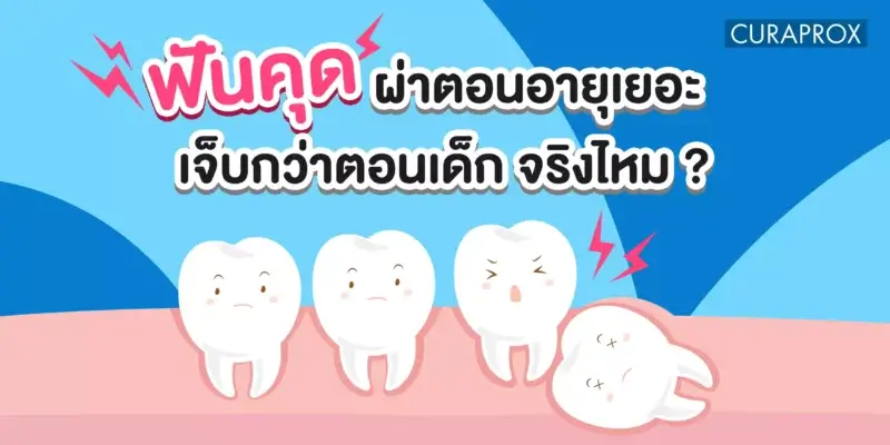 ฟันคุด