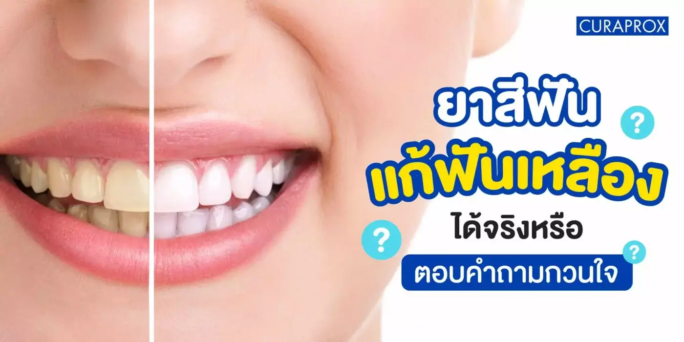 แก้ฟันเหลือง