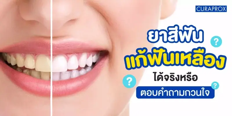 แก้ฟันเหลือง