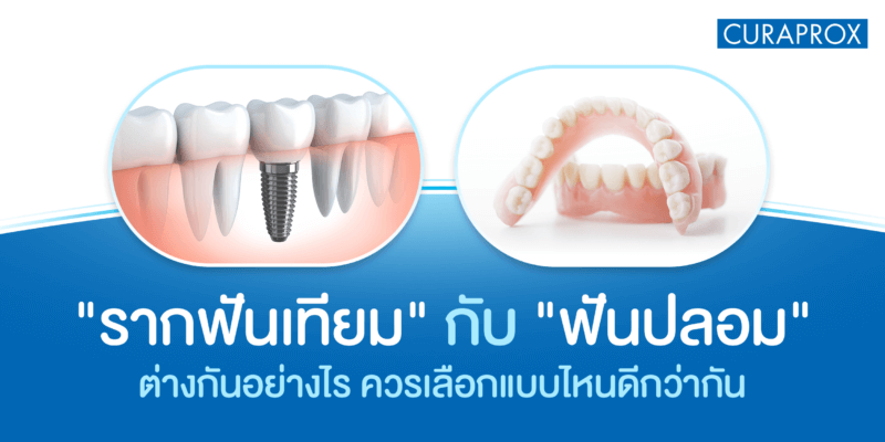 ระหว่างรากฟันเทียม กับ ฟันปลอม เลือกทำแบบไหนดีกว่ากัน