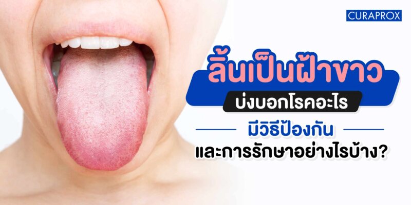 ลิ้นเป็นฝ้าขาวเกิดจากอะไร