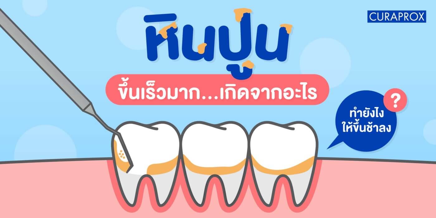 หินปูนขึ้นเร็วมาก ทำยังไงให้ขึ้นช้า
