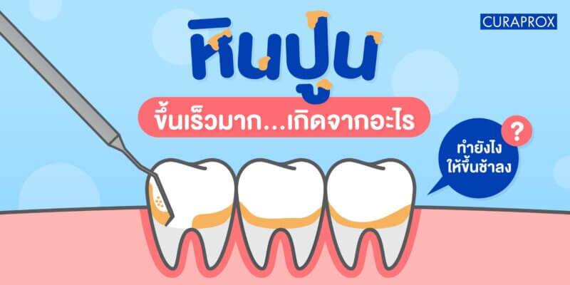หินปูนขึ้นเร็วมาก ทำยังไงให้ขึ้นช้า