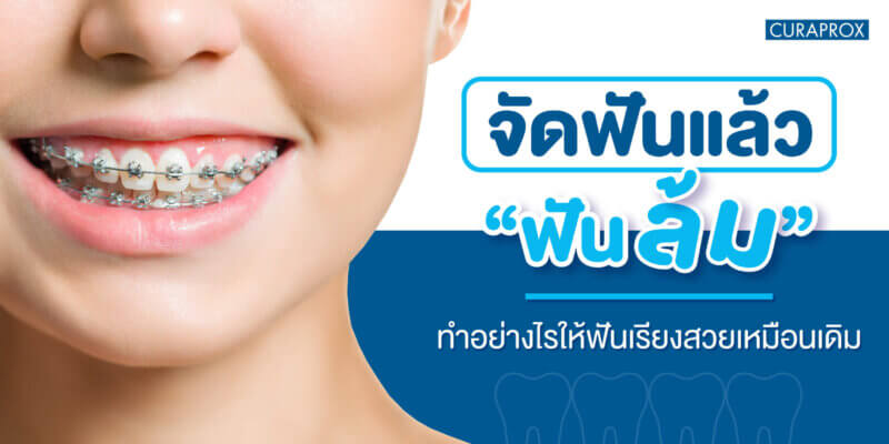 แก้ปัญหาจัดฟันแล้วฟันล้ม