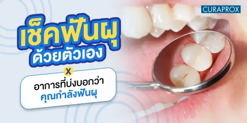 เช็กอาการฟันผุ สัญญาณที่บ่งบอกว่าคุณกำลังฟันผุ