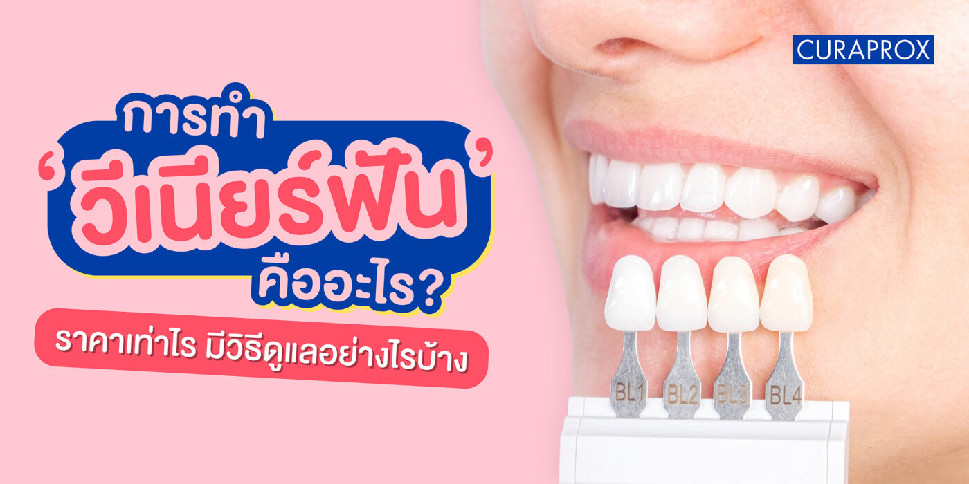 วีเนียร์ฟันคืออะไร ราคาเท่าไร ต้องดูแลอย่างไรให้อยู่ได้นาน