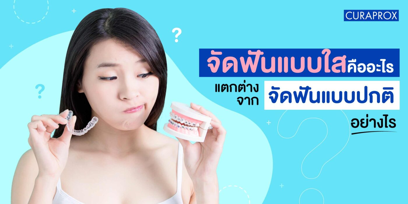 จัดฟันแบบใสคืออะไร แตกต่างจากจัดฟันแบบปกติอย่างไร
