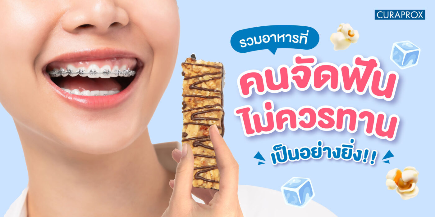 รวมอาหารที่คนจัดฟันไม่ควรทานเป็นอย่างยิ่ง