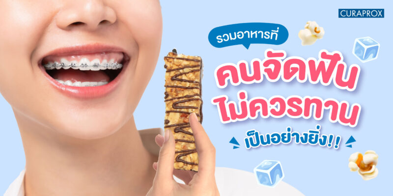 รวมอาหารที่คนจัดฟันไม่ควรทานเป็นอย่างยิ่ง