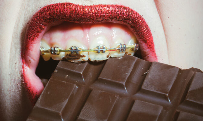 คนจัดฟันสามารถกินอาหารอะไรได้บ้าง
