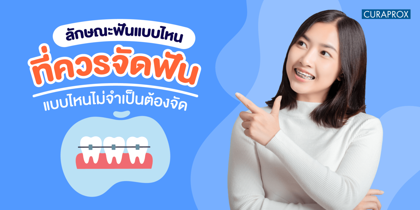 ลักษณะฟันแบบไหนที่ควรจัดฟัน แบบไหนไม่จำเป็นต้องจัด