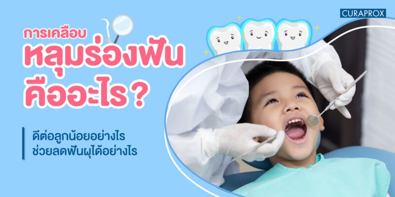 การเคลือบหลุมร่องฟันคืออะไร ดีต่อลูกน้อยอย่างไร ช่วยลดฟันผุได้อย่างไร