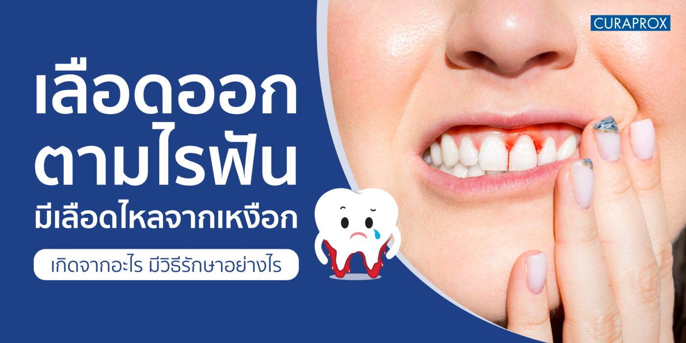 เลือดออกตามไรฟัน