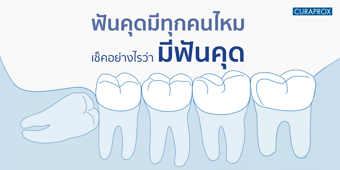 ฟันคุดมีทุกคนไหม ต้องผ่าหรือไม่ และเช็กอย่างไรว่ามีฟันคุด