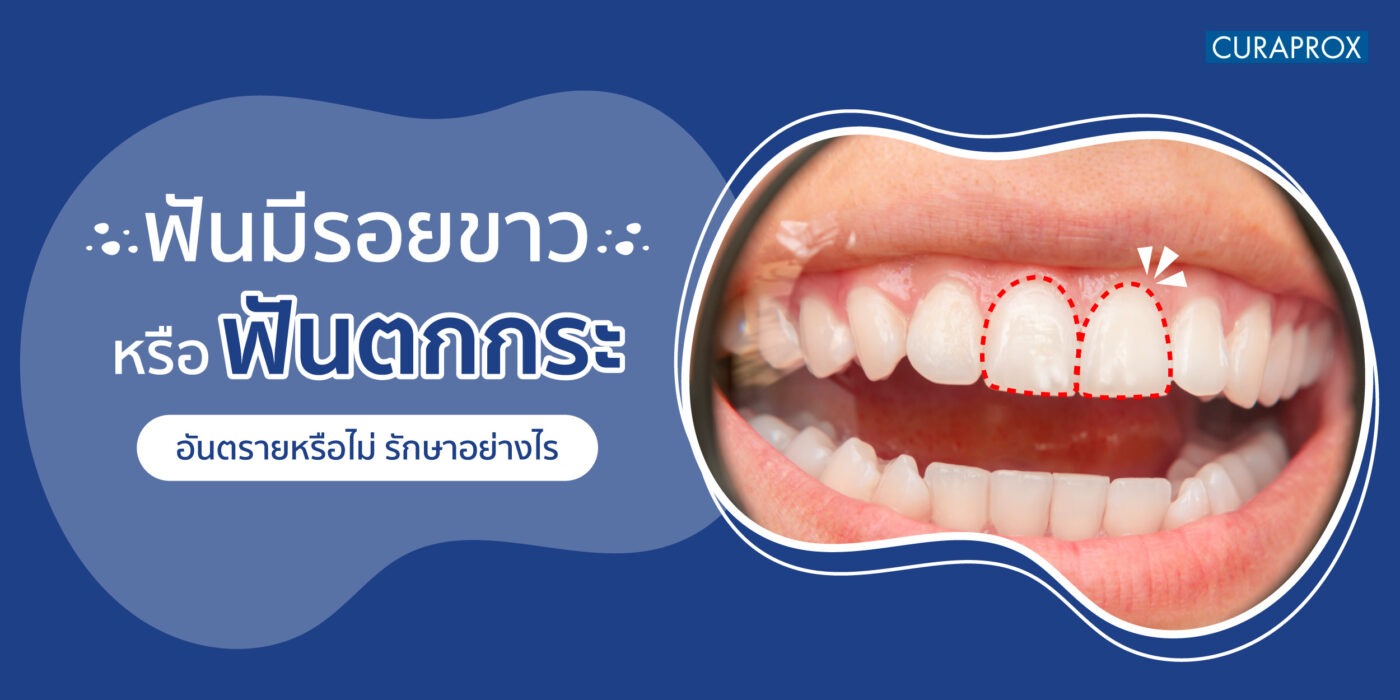ฟันตกกระ
