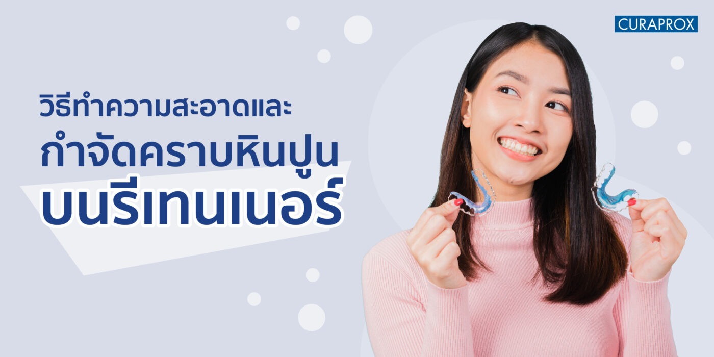 วิธีทำความสะอาด และกําจัดคราบหินปูนบนรีเทนเนอร์