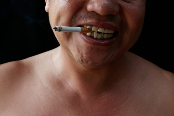 คราบหินปูนสีดำ